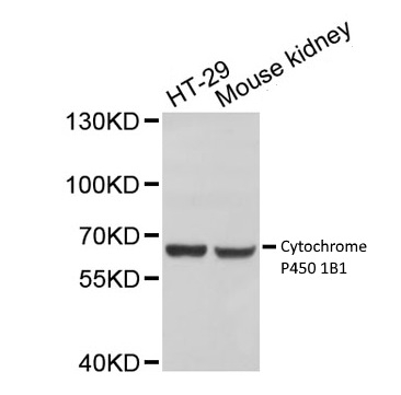 Anti Cytochrome P450 1B1 Antibody gallery image 2
