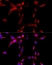 Anti Cytochrome P450 1B1 Antibody thumbnail image 3