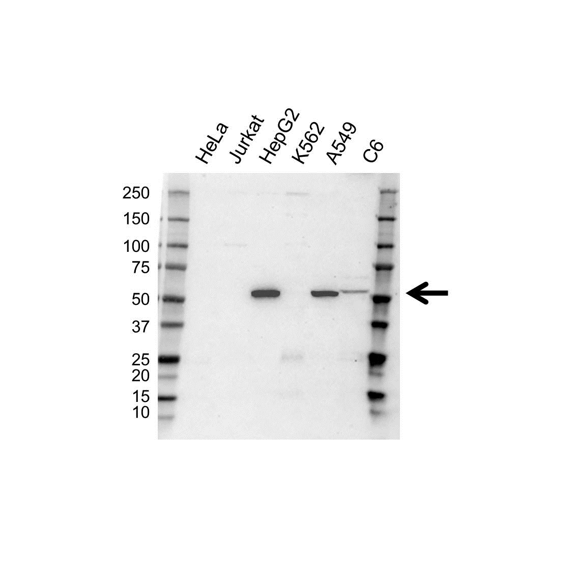Anti Cytochrome P450 Aromatase Antibody (PrecisionAb Polyclonal Antibody) gallery image 1