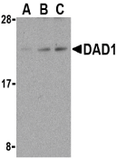 Anti DAD1 Antibody gallery image 1