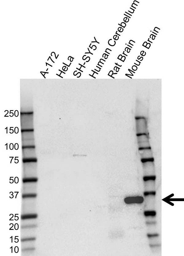 Anti Darpp-32 Antibody (PrecisionAb Polyclonal Antibody) gallery image 1