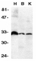Anti Human DcR3 (N-Terminal) Antibody thumbnail image 1