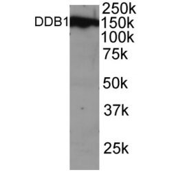 Anti DDB1 (C-Terminal) Antibody gallery image 1