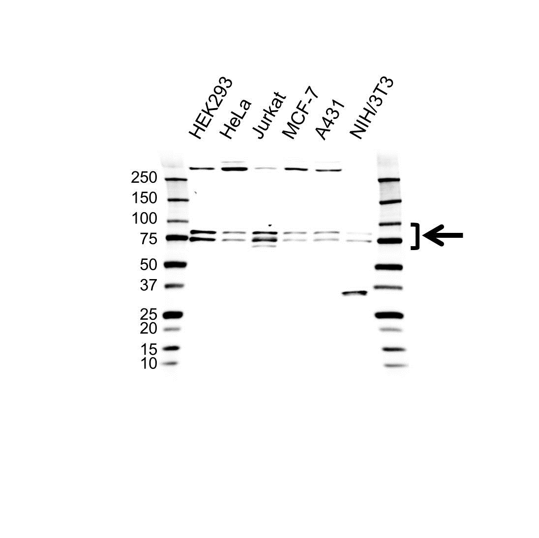 Anti DDX17 Antibody (PrecisionAb Polyclonal Antibody) gallery image 1