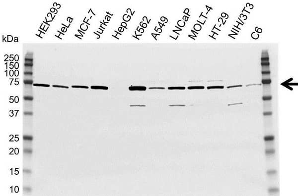 Anti DDX5 Antibody (PrecisionAb Polyclonal Antibody) gallery image 1