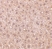 Anti Human DEDAF Antibody thumbnail image 2