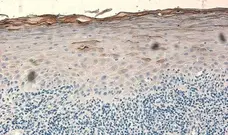 Anti Human Defensin Beta 2 Antibody gallery image 1