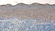 Anti Human Defensin Beta 2 Antibody gallery image 2