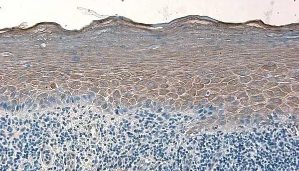 Anti Human Defensin Beta 2 Antibody gallery image 2