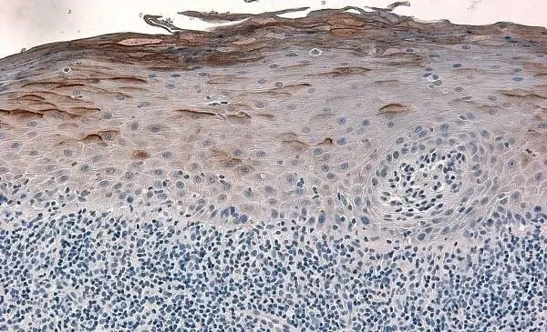 Anti Human Defensin Beta 2 Antibody gallery image 3