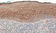 Anti Human Defensin Beta 2 Antibody gallery image 4