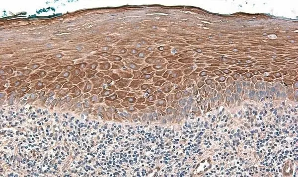 Anti Human Defensin Beta 2 Antibody gallery image 4