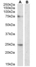 Anti Delta-Like Protein 1 Antibody thumbnail image 3