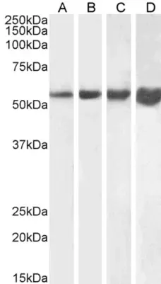 Anti Human Desmin (C-Terminal) Antibody gallery image 1