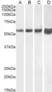 Anti Human Desmin (C-Terminal) Antibody thumbnail image 1