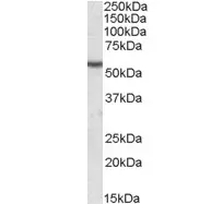 Anti Human Desmin (C-Terminal) Antibody gallery image 2