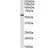 Anti Human Desmin (C-Terminal) Antibody thumbnail image 2