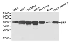 Anti DFF-45 Antibody gallery image 1