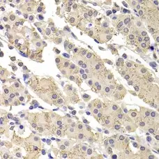 Anti DFF-45 Antibody gallery image 2