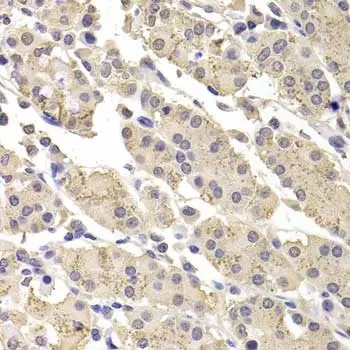 Anti DFF-45 Antibody gallery image 2