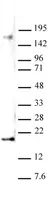 Anti Di-Methyl-Histone H3 (Lys27) Antibody thumbnail image 2