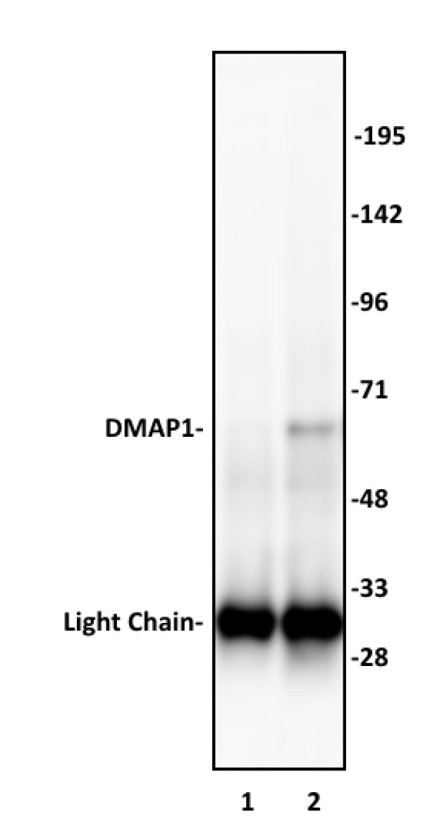 Anti Human DMAP1 Antibody gallery image 1