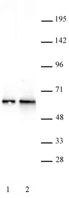 Anti Human DMAP1 Antibody gallery image 2