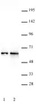 Anti Human DMAP1 Antibody thumbnail image 2