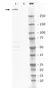 Anti DNA PKcs Antibody thumbnail image 1