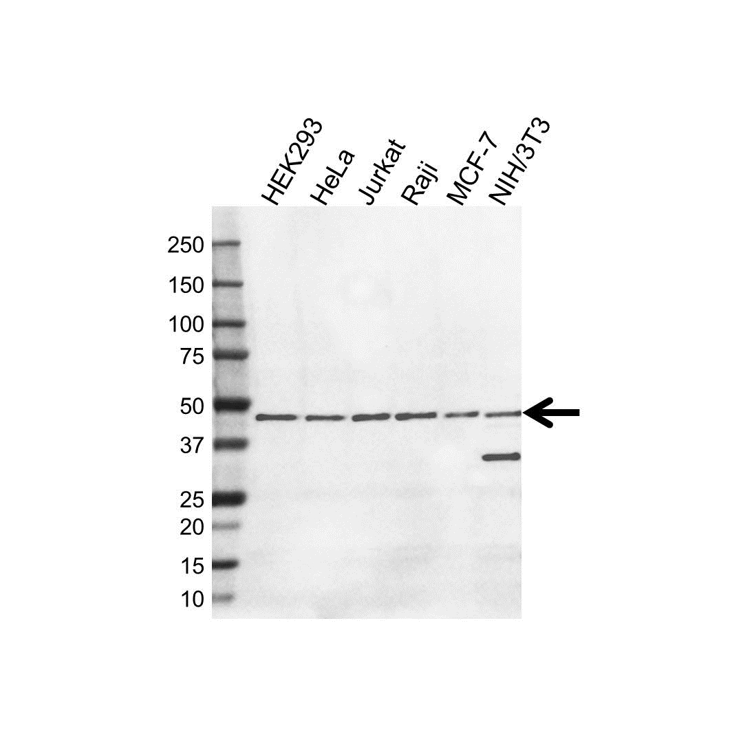 Anti DNAJB11 Antibody (PrecisionAb Polyclonal Antibody) gallery image 1