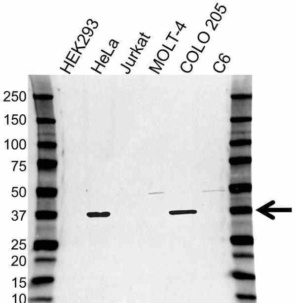 Anti DNAJB6 Antibody (PrecisionAb Polyclonal Antibody) gallery image 1