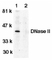 Anti Human DNase II (C-Terminal) Antibody thumbnail image 1