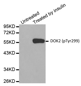 Anti DOK2 (pTyr299) Antibody gallery image 1