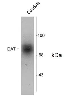 Anti Human Dopamine Transporter (C-Terminal) Antibody gallery image 1