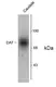 Anti Human Dopamine Transporter (C-Terminal) Antibody thumbnail image 1
