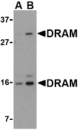 Anti DRAM (C-Terminal) Antibody gallery image 1