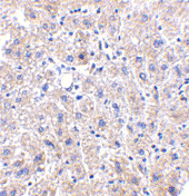 Anti DRAM (C-Terminal) Antibody gallery image 2