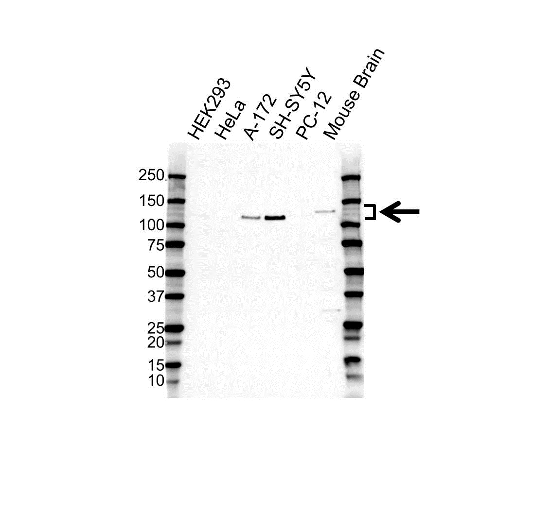 Anti Drebrin 1 Antibody (PrecisionAb Polyclonal Antibody) gallery image 1