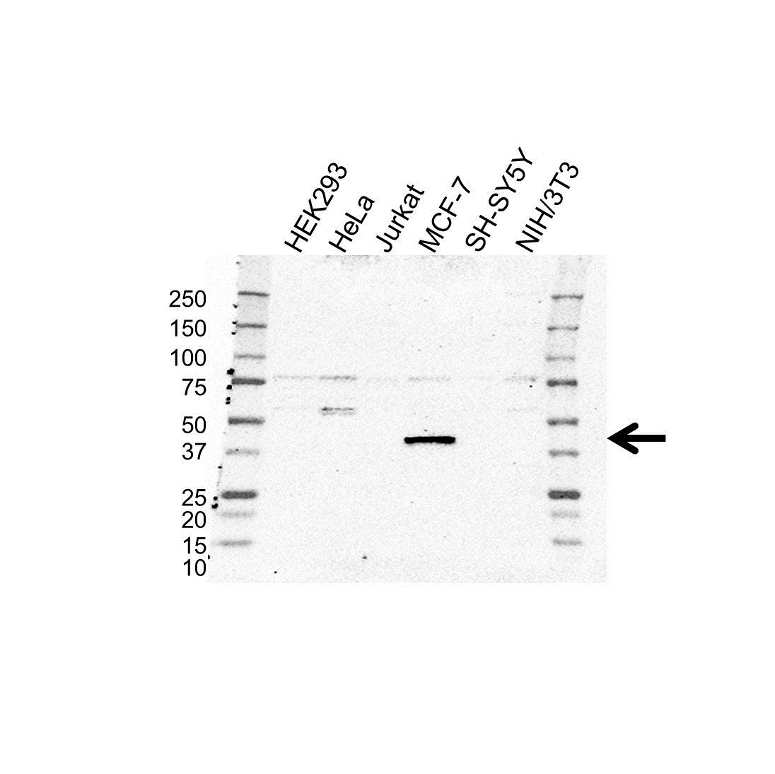 Anti Dynactin 2 Antibody (PrecisionAb Polyclonal Antibody) gallery image 1