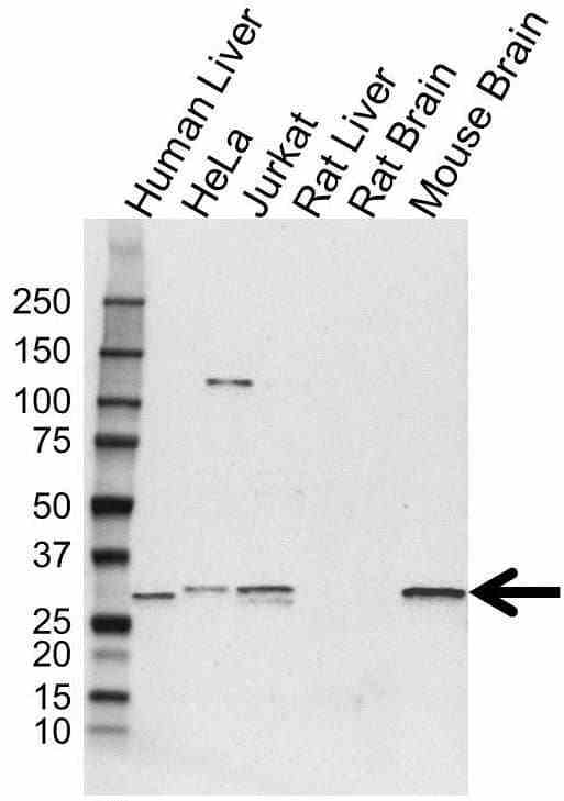 Anti E3 Ubiquitin Ligase SIAH1 Antibody (PrecisionAb Polyclonal Antibody) gallery image 1