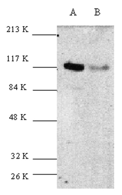 Anti E3 UBIQUITIN-PROTEIN Ligase CBL Antibody gallery image 1