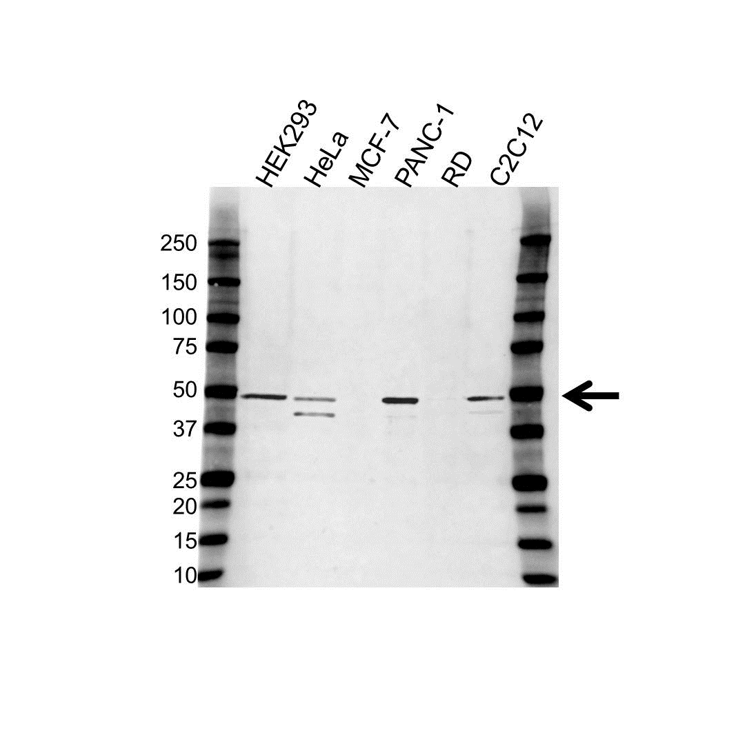 Anti eEF1A1 Antibody (PrecisionAb Polyclonal Antibody) gallery image 1