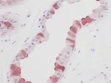 Anti Human EGF Antibody gallery image 1