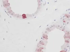 Anti Human EGF Antibody gallery image 2