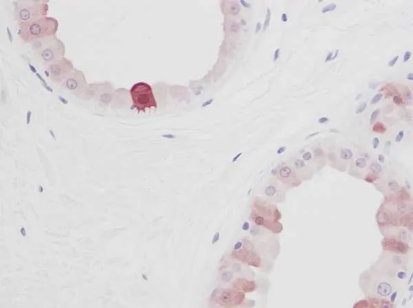 Anti Human EGF Antibody gallery image 2
