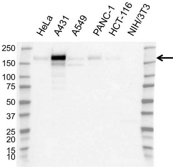 Anti EGF Receptor Antibody (PrecisionAb Polyclonal Antibody) gallery image 1