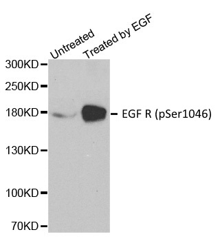 Anti EGF R (pSer1046) Antibody gallery image 1