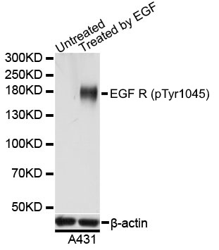 Anti EGF R (pTyr1045) Antibody gallery image 1