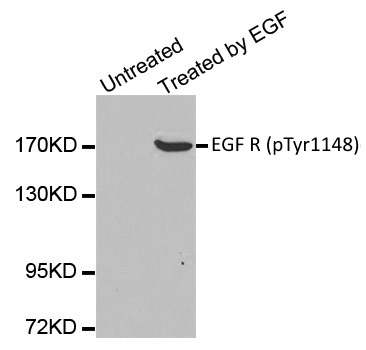Anti EGF R (pTyr1148) Antibody gallery image 1
