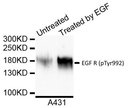 Anti EGF R (pTyr992) Antibody gallery image 1